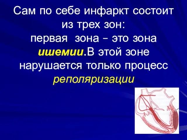 Сам по себе инфаркт состоит из трех зон: первая зона –