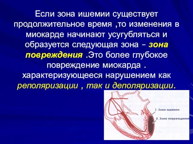 Если зона ишемии существует продолжительное время ,то изменения в миокарде начинают