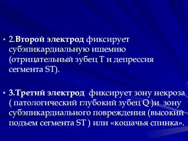 2.Второй электрод фиксирует субэпикардиальную ишемию (отрицательный зубец Т и депрессия сегмента