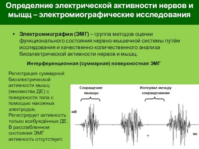 Определние электрической активности нервов и мыщц – электромиографические исследования Электромиография (ЭМГ)