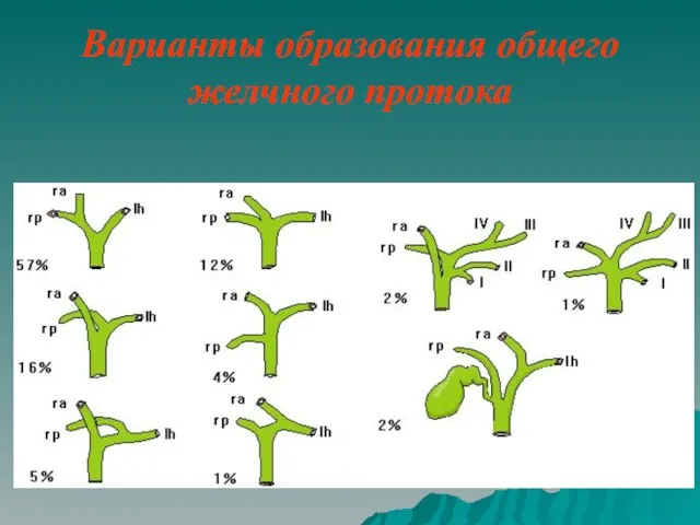 Варианты образования общего желчного протока