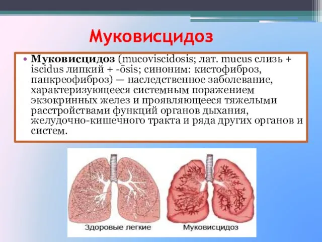 Муковисцидоз Муковисцидоз (mucoviscidosis; лат. mucus слизь + iscidus липкий + -ōsis;