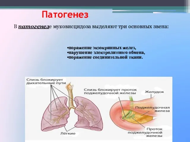 Патогенез поражение экзокринных желез, нарушение электролитного обмена, поражение соединительной ткани. В