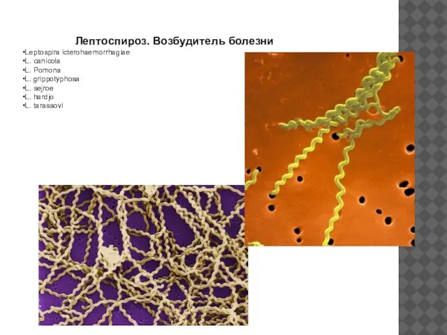 Лептоспироз. Возбудитель болезни Leptospira icterohaemorrhagiae L. canicola L. Pomona L. grippotyphosa