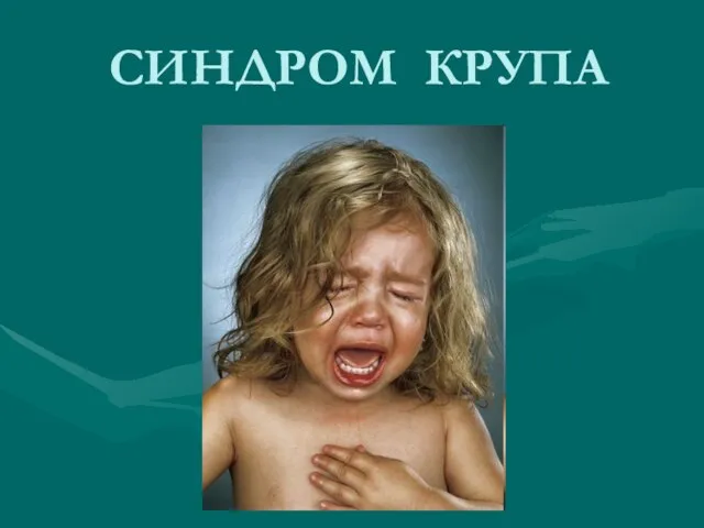 СИНДРОМ КРУПА