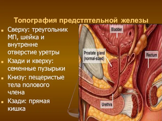 Топография предстптельной железы Сверху: треугольник МП, шейка и внутренне отверстие уретры