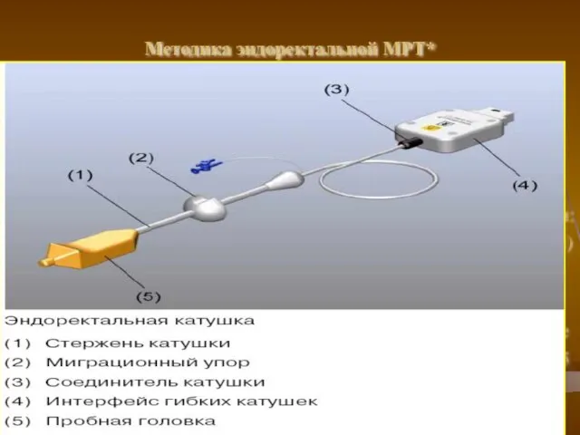 Методика эндоректальной МРТ* * МР-исследование лучше выполнять до или после 4-5