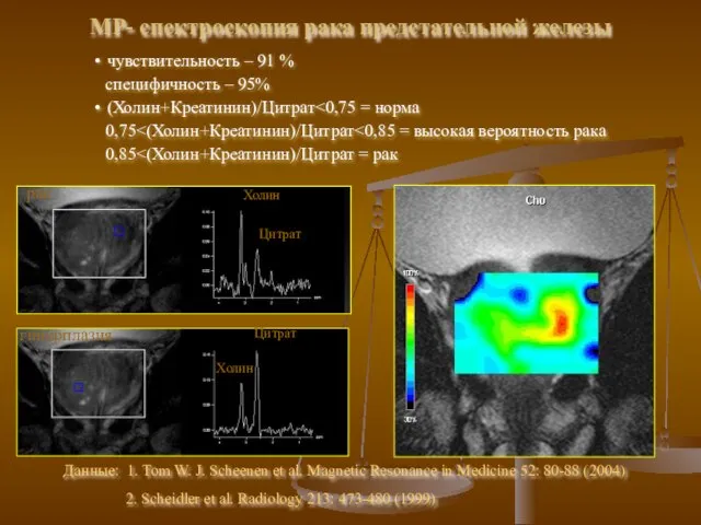 Цитрат Холин Данные: 1. Tom W. J. Scheenen et al. Magnetic