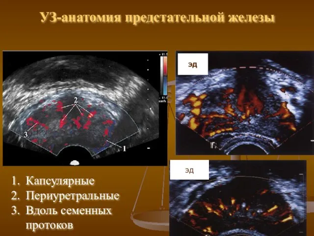 УЗ-анатомия предстательной железы Капсулярные Периуретральные Вдоль семенных протоков