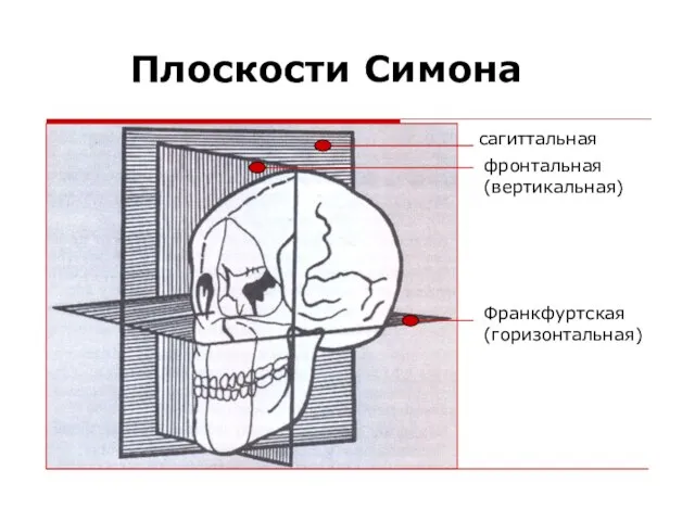 сагиттальная фронтальная (вертикальная) Франкфуртская (горизонтальная) Плоскости Симона