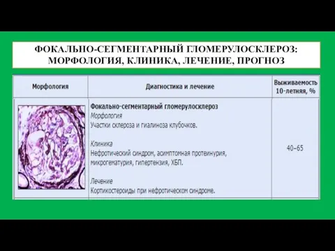 ФОКАЛЬНО-СЕГМЕНТАРНЫЙ ГЛОМЕРУЛОСКЛЕРОЗ: МОРФОЛОГИЯ, КЛИНИКА, ЛЕЧЕНИЕ, ПРОГНОЗ