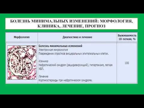 БОЛЕЗНЬ МИНИМАЛЬНЫХ ИЗМЕНЕНИЙ: МОРФОЛОГИЯ, КЛИНИКА, ЛЕЧЕНИЕ, ПРОГНОЗ