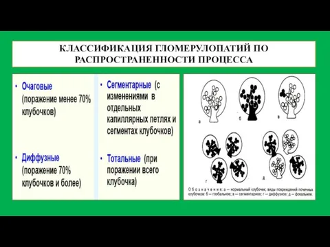 КЛАССИФИКАЦИЯ ГЛОМЕРУЛОПАТИЙ ПО РАСПРОСТРАНЕННОСТИ ПРОЦЕССА