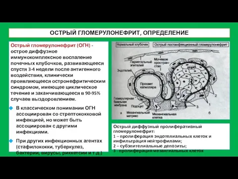 ОСТРЫЙ ГЛОМЕРУЛОНЕФРИТ, ОПРЕДЕЛЕНИЕ Острый гломерулонефрит (ОГН) - острое диффузное иммунокомплексное воспаление