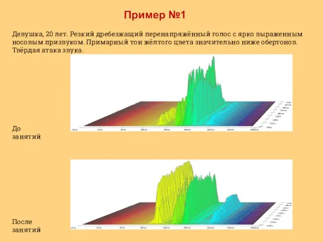 Пример №1 Девушка, 20 лет. Резкий дребезжащий перенапряжённый голос с ярко