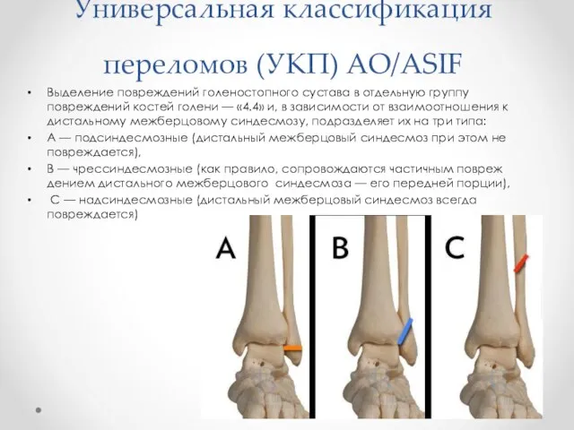 Универсальная классификация переломов (УКП) AO/ASIF Выделение по­вреждений голеностопного сустава в отдельную