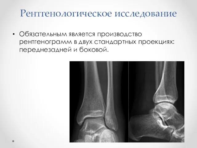 Рентгенологическое исследование Обязательным является производство рентгенограмм в двух стандартных проекциях: переднезадней и боковой.