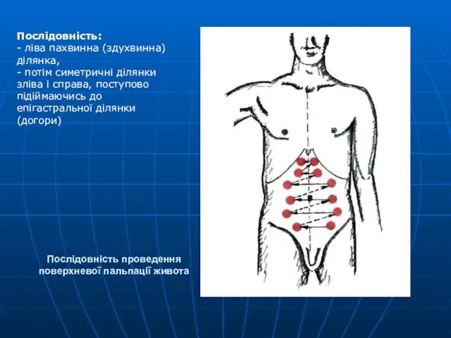 Послідовність проведення поверхневої пальпації живота Послідовність: - ліва пахвинна (здухвинна) ділянка,