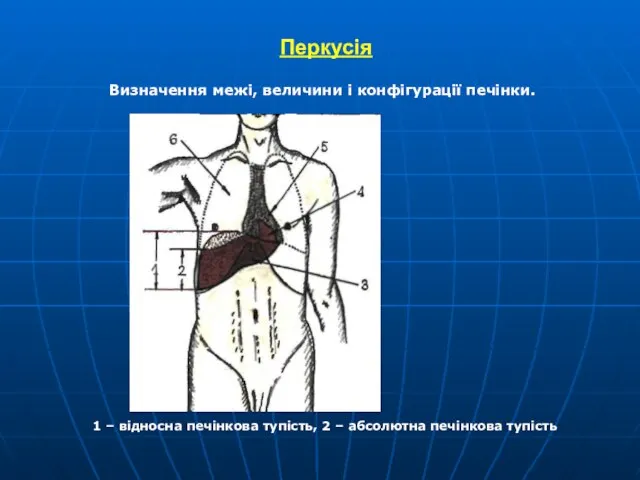 Перкусія Визначення межі, величини і конфігурації печінки. 1 – відносна печінкова