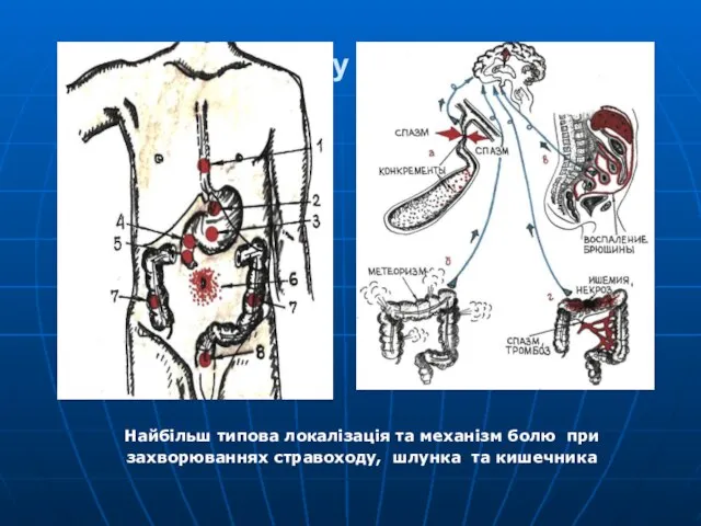 Біль у животі Найбільш типова локалізація та механізм болю при захворюваннях стравоходу, шлунка та кишечника