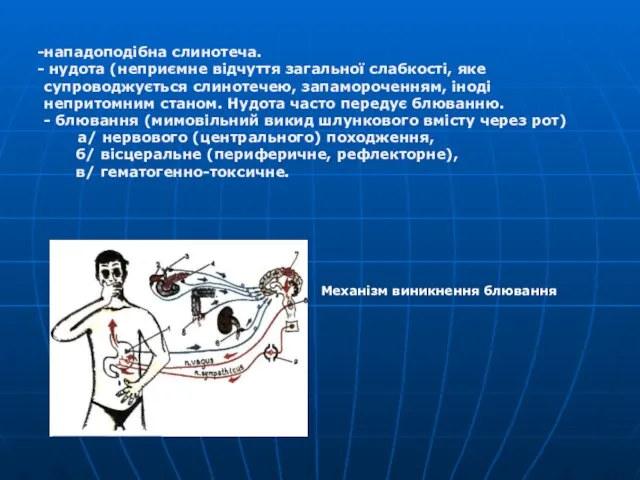 Механізм виникнення блювання нападоподібна слинотеча. нудота (неприємне відчуття загальної слабкості, яке