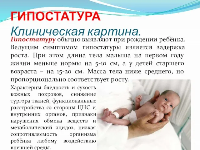 ГИПОСТАТУРА Клиническая картина. Гипостатуру обычно выявляют при рождении ребёнка. Ведущим симптомом