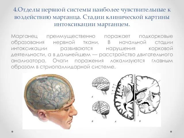 4.Отделы нервной системы наиболее чувствительные к воздействию марганца. Стадии клинической картины