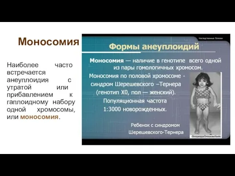 Моносомия Наиболее часто встречается анеуплоидия с утратой или прибавлением к гаплоидному набору одной хромосомы, или моносомия.