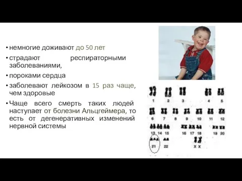 немногие доживают до 50 лет страдают респираторными заболеваниями, пороками сердца заболевают