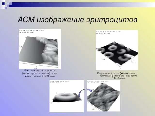 АСМ изображение эритроцитов Отдельные клетки (химическая фиксация), поле сканирования 14×18 мкм.