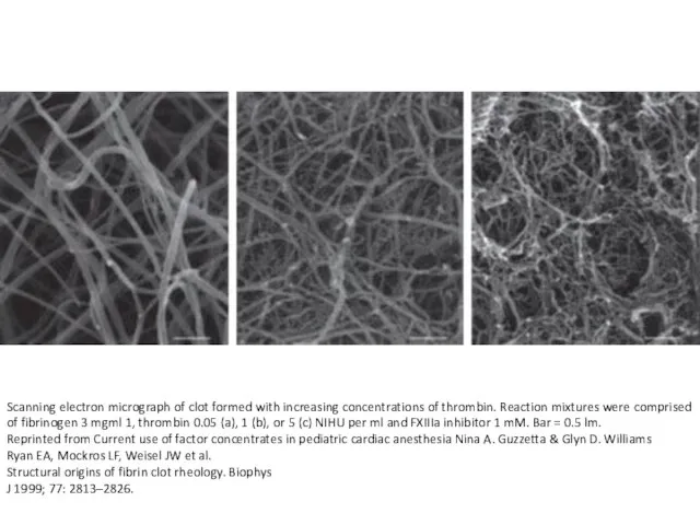 Scanning electron micrograph of clot formed with increasing concentrations of thrombin.