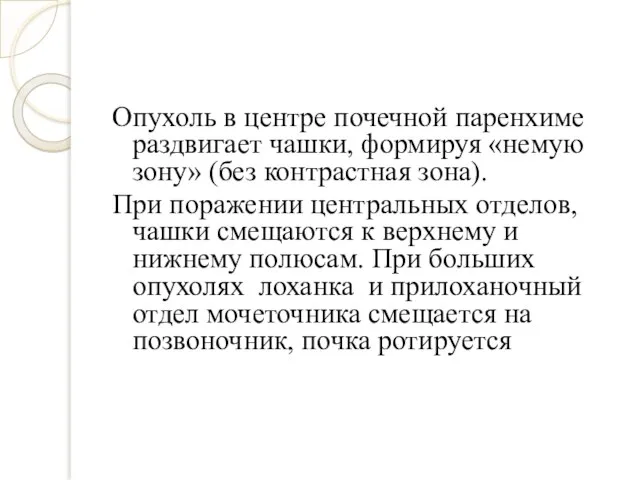 Опухоль в центре почечной паренхиме раздвигает чашки, формируя «немую зону» (без