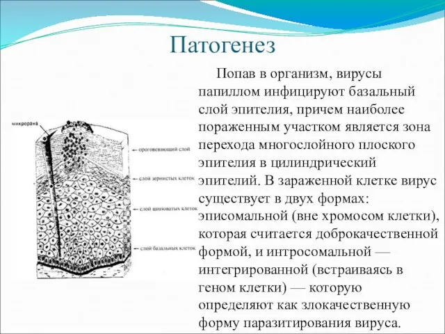 Патогенез Попав в организм, вирусы папиллом инфицируют базальный слой эпителия, причем