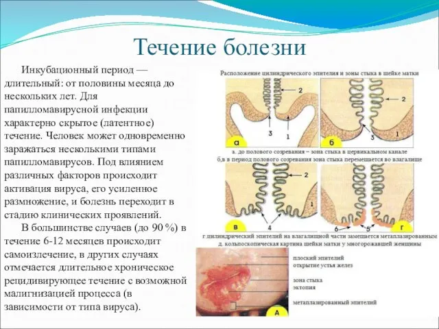 Течение болезни Инкубационный период — длительный: от половины месяца до нескольких