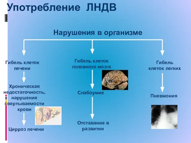 Употребление ЛНДВ Гибель клеток печени Хроническая недостаточность, нарушение свертываемости крови Цирроз