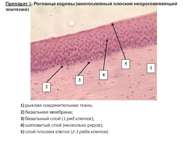 1) рыхлая соединительная ткань; 2) базальная мембрана; 3) базальный слой (1