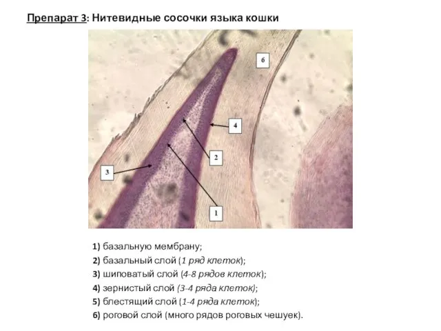 1) базальную мембрану; 2) базальный слой (1 ряд клеток); 3) шиповатый