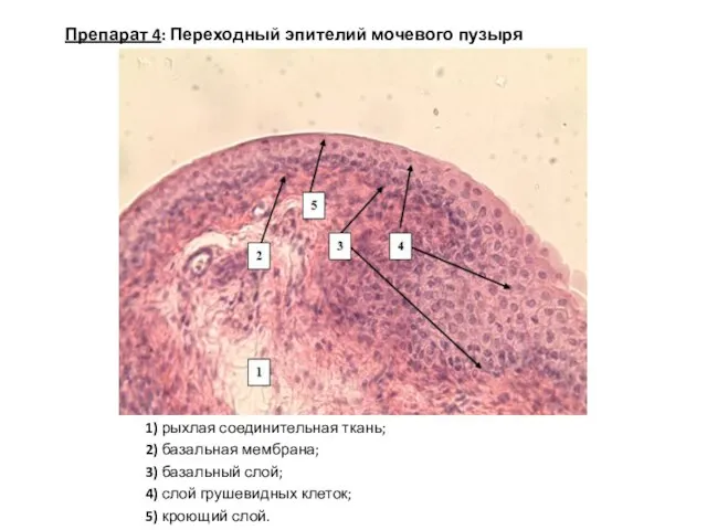 1) рыхлая соединительная ткань; 2) базальная мембрана; 3) базальный слой; 4)
