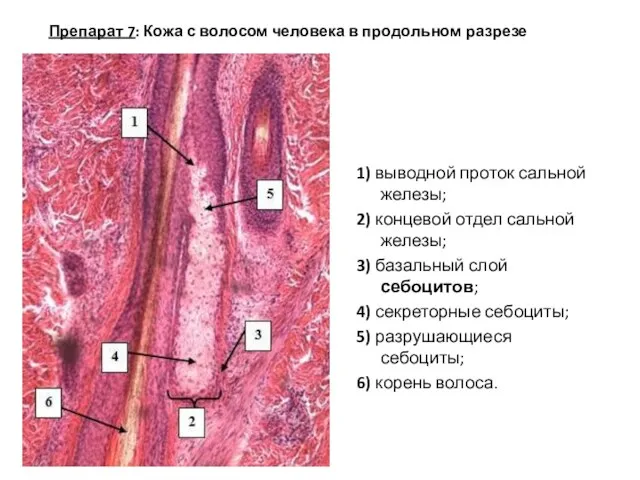 Препарат 7: Кожа с волосом человека в продольном разрезе 1) выводной