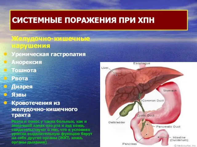 Желудочно-кишечные нарушения Уремическая гастропатия Анорексия Тошнота Рвота Диарея Язвы Кровотечения из
