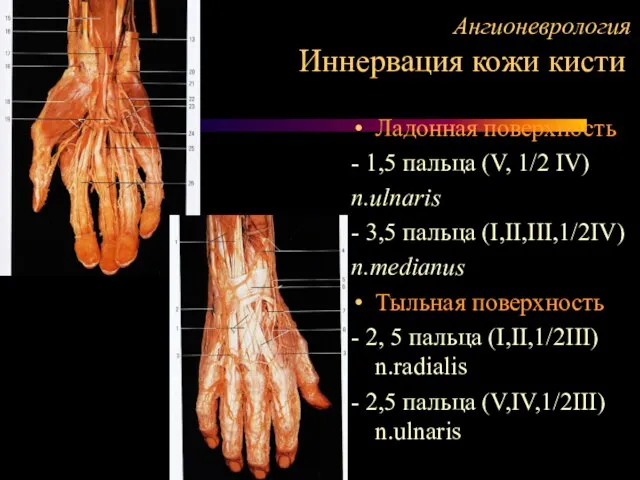 Ангионеврология Иннервация кожи кисти Ладонная поверхность - 1,5 пальца (V, 1/2