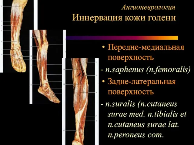Ангионеврология Иннервация кожи голени Передне-медиальная поверхность - n.saphenus (n.femoralis) Задне-латеральная поверхность