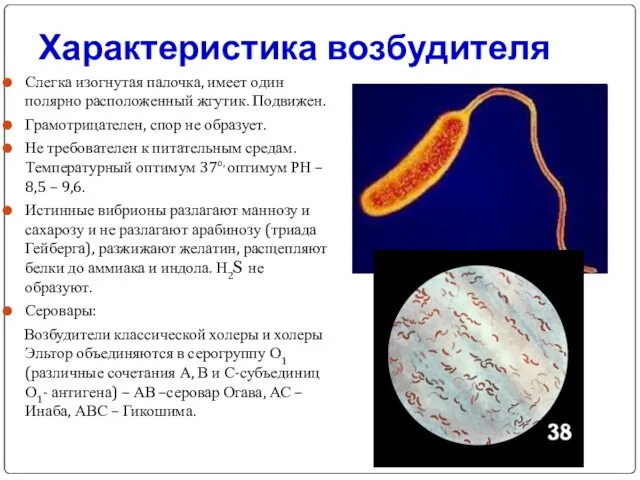 Характеристика возбудителя Слегка изогнутая палочка, имеет один полярно расположенный жгутик. Подвижен.