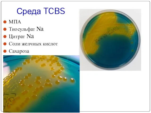 Среда TCBS МПА Тиосульфат Na Цитрат Na Соли желчных кислот Сахароза