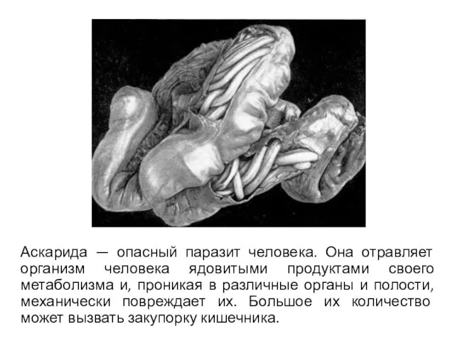 Аскарида — опасный паразит человека. Она отравляет организм человека ядовитыми продуктами