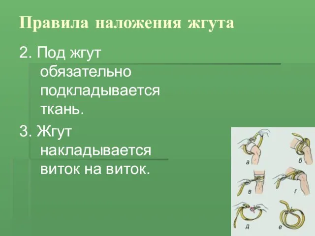 Правила наложения жгута 2. Под жгут обязательно подкладывается ткань. 3. Жгут накладывается виток на виток.