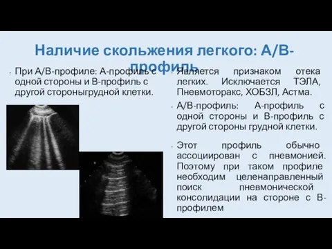 Наличие скольжения легкого: А/В-профиль При А/В-профиле: А-профиль с одной стороны и