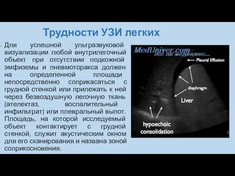 Трудности УЗИ легких Для успешной ультразвуковой визуализации любой внутрилегочный объект при