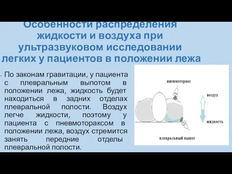 Особенности распределения жидкости и воздуха при ультразвуковом исследовании легких у пациентов