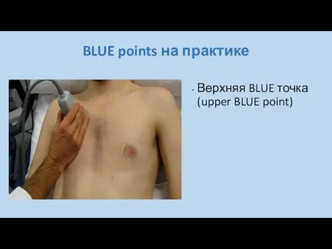 BLUE points на практике Верхняя BLUE точка (upper BLUE point)